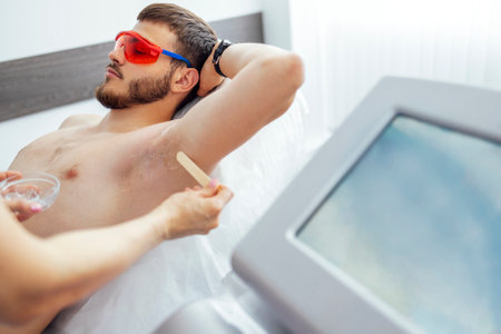 Beauty salon beautician applies cooling gel to clients skin. Preparing the skin of young man for laser hair removal of the armpit. Close up of brunette man with special orange glasses.の写真素材