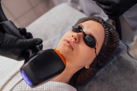 Young brunette woman receiving photo epilation while visiting beauty center on salon, professional female beautician doing laser hair removal procedure on clients face. Cosmetology conceptの写真素材