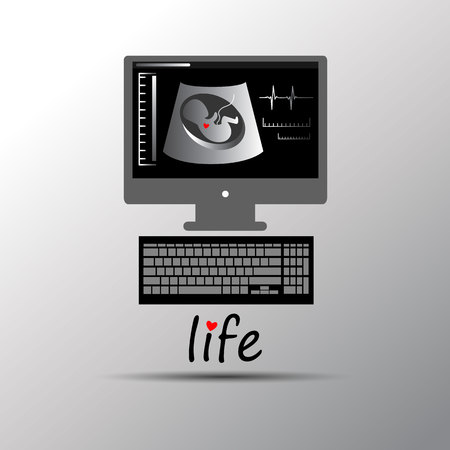 Doctor examining baby in tummy through monitorのイラスト素材