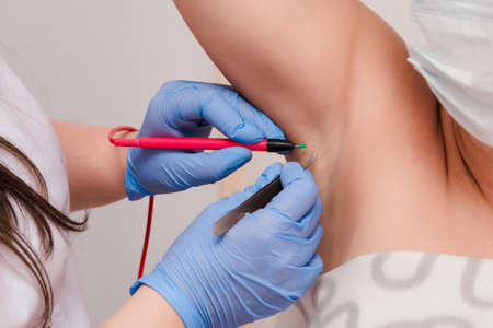 A handsome cosmetologist with long dark hair is performing an electrolysis procedure. In the beautician's office. Close-up.の写真素材