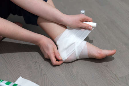 callus on leg. Girl uses ointment,  bandage to treat calluse. foot treatment