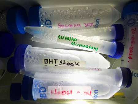 Collection of conical plastic tubes of different volumes and capacities with blue screw caps with...