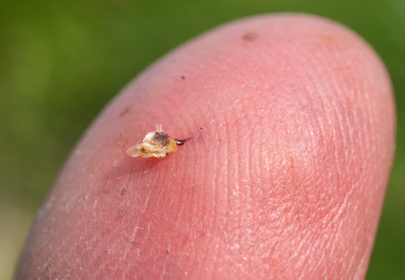 Bee venom is used in alternative medicine.の写真素材