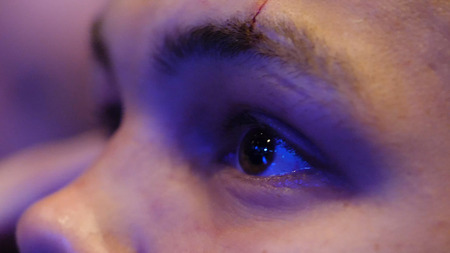 Young man looking up. yes of a young man closeup. Young man with a cut over the eye some idea