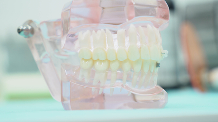 Close-up of denture jaw. Media. Denture of jaws with teeth with transparent gums stands on table in dental office. Modern design of jaw prosthesisの写真素材