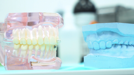 A model of the jaw on the table of the dental clinic, dental care and medicine concept. Media. Close...