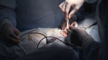 Surgeon applying stitches. Action. Close-up of professional surgeons completing complex operation under anesthesia. Suturing in operating roomの写真素材