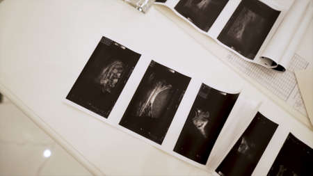 Close up of ultrasound images lying on white table background. Action. Concept of health care and...