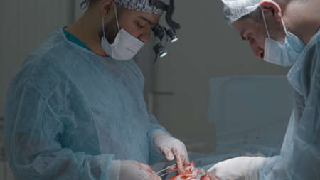 Surgeons perform bloody operation. Action. Two professional surgeons work together on complex operation. Experienced surgeons cut and stop bleedingの写真素材