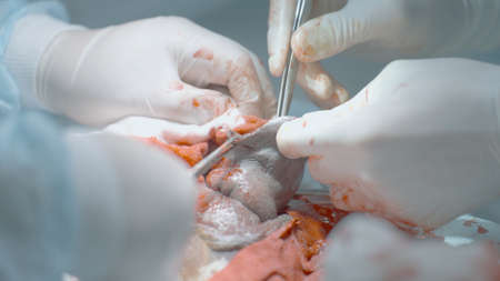 Close-up operation on male organ. Action. Bloody operation on male sexual organ. Treatment, fracture and enlargement of male genital organ. Penis Surgeryの写真素材