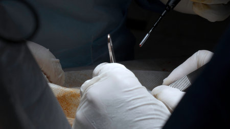 Close up of process of the real surgery at the hospital. Action. Medical tools and equipment.