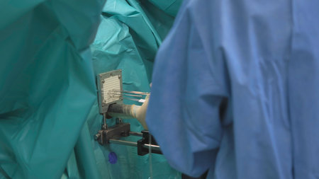 Surgeon with games performs operation. Creative. Close-up of surgeon piercing installation with needles in operating room. Operating room with surgeon and equipmentの写真素材