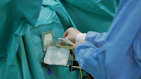 Surgeon connecting wires. Creative. Surgeon connects wires for operation. Preparation for operation and connection of equipment.の写真素材