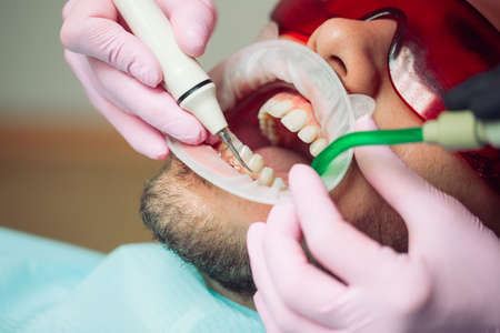 Professional teeth cleaning. Dentist cleans the teeth of a male patient.の写真素材