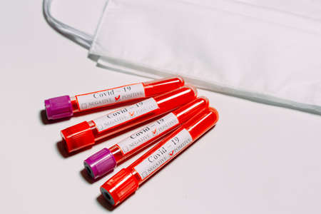 The vaccine for Coronavirus. Positive blood Tests for Coronavirus in test tubes.の写真素材