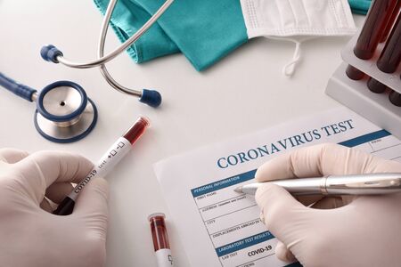 Doctor filling out coronavirus test form on the laboratory bench with blood samples to analyze. Top view.の写真素材