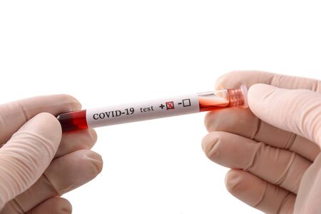 Hands with protective gloves taking test tube with blood sample infected with the covid-19 virus. Top view.の写真素材