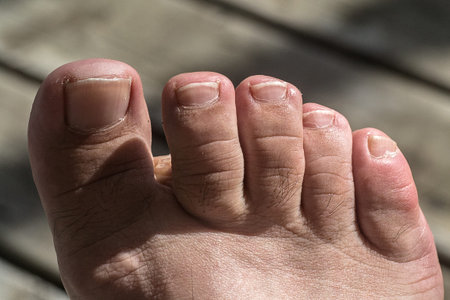 Toes