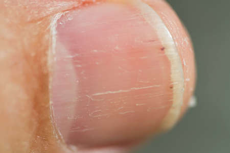 A close up of a thumb nailの写真素材