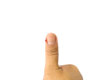 Finger has blood because of accident on white backgroundの写真素材