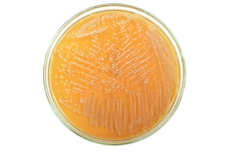 The bacteria on the agar plate.の写真素材