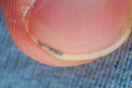 Dirt stuck under the man nail super macro