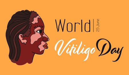 Vitiligo Girl. Vector isolated portrait of african woman with pigment spots. Genetic skin problem - Side view faceのイラスト素材