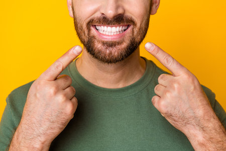 Photo of good mood attractive guy dressed green t-shirt showing two fingers white teeth isolated yellow color backgroundの写真素材