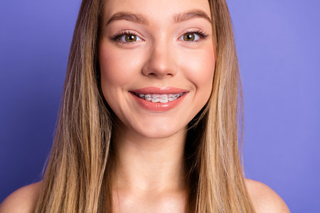 Smiling young woman with braces on a purple background showcasing confidence, youthfulness, and...