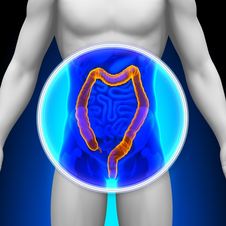 Medical X-Ray Scan Colon