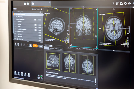 MRI brain scan on a computer screen. Advanced medical imaging technology showing axial, coronal, and...
