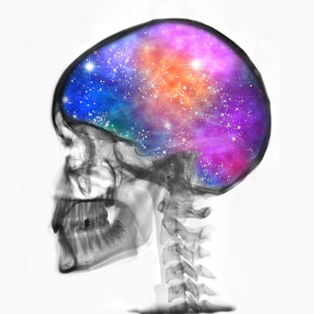 rtg of human skull with galaxyの写真素材