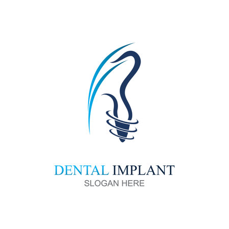 Dental implant logo design concept vector, Dental Care logo templateのイラスト素材