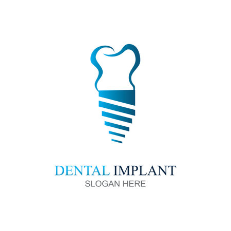 Dental implant logo design concept vector, Dental Care logo templateのイラスト素材
