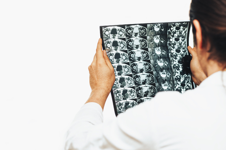 Doctor holds MRI scan or X-Ray film of heap joint in his hands, copy spaceの写真素材
