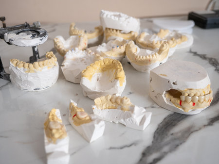 Dental prosthetic models with ceramic crowns for orthodontics, dental implants, prosthodontics,...