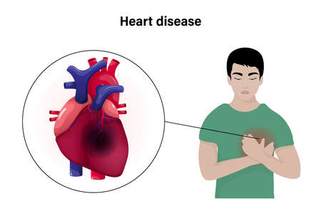 Heart disease vector concept. Man with heart attack symptom.