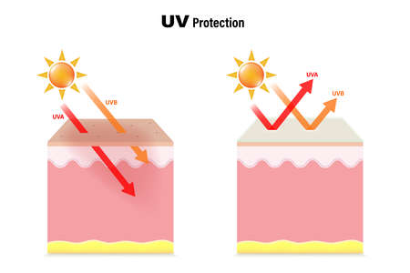 UV Protecttion. The difference between skin without sunscreen lotion and skin with sun protection lotion. &#xD;&#xA;UVA and UVB radiographs of skin damage.のイラスト素材
