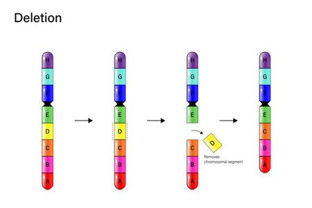 Chromosome Deletion. Genetic mutation. Alteration of chromosome structure. Vector for scientific study and biological genetics.のイラスト素材