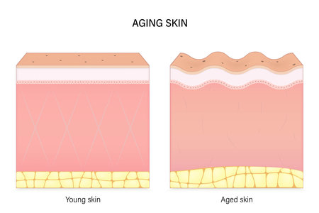 Aging skin. Comparison of young and aged skin. Facial skin problems. Vector for advertising about beauty and medical treatment.のイラスト素材