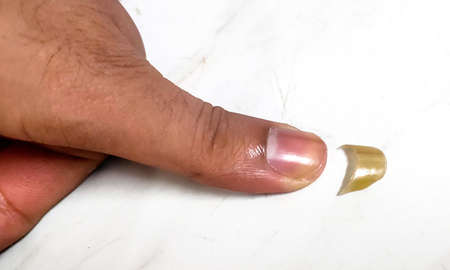 A human thumb and clipped nail on white background