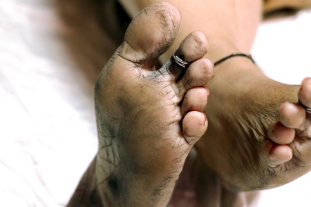 High-resolution close-up image of dry, cracked heels and soles of bare feet, highlighting skin texture and foot care issues.の写真素材