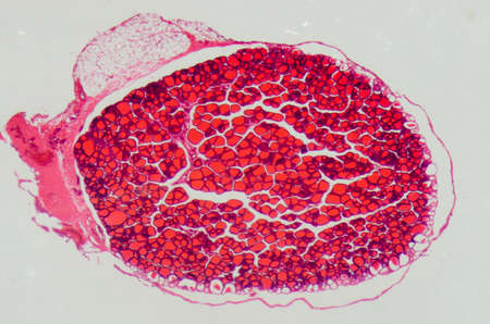 science medical anthropotomy physiology microscopic section of human thyroid gland backgroundの写真素材