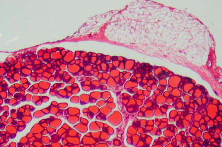 science medical anthropotomy physiology microscopic section of human thyroid gland background