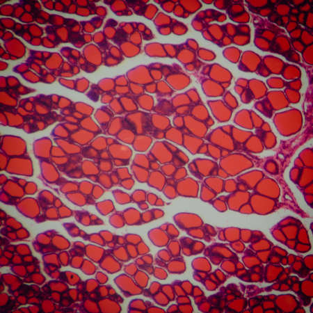 science medical anthropotomy physiology microscopic section of human thyroid gland backgroundの写真素材