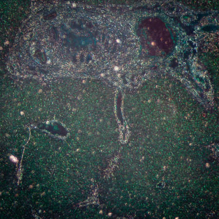 science medical anthropotomy physiology micrograph of liver tissueの写真素材