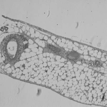 science medical anthropotomy physiology micrograph of blood vessel, artery and vein.の写真素材