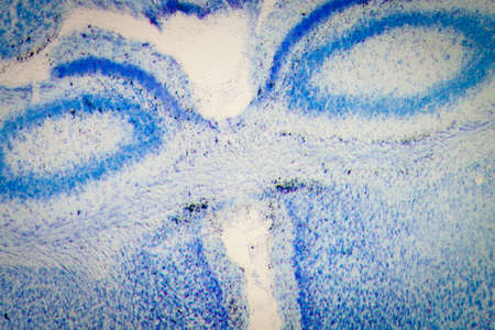 science medical microscopy micrograph, rat brain hippocampal neuronsの写真素材