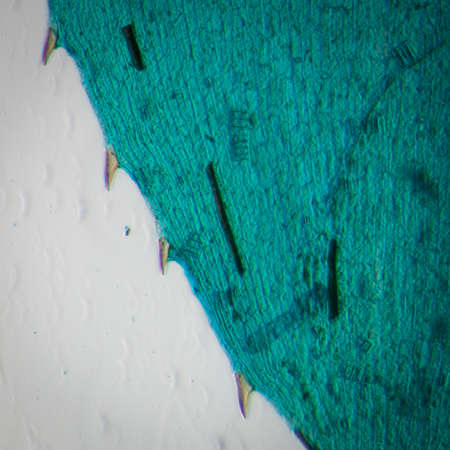 science microscopy micrograph black algae leaf Hydrilla verticillata microの写真素材