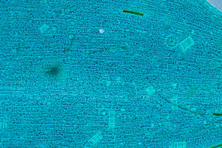 science microscopy micrograph black algae leaf Hydrilla verticillata microの写真素材